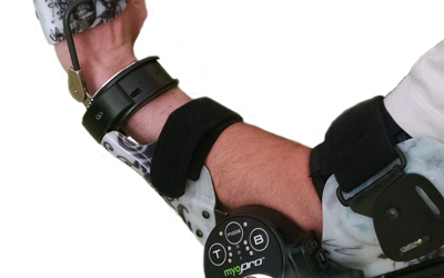 FDA-Compliant Medical Device Manufacturing of Myomo Myoelectric Upper Limb Orthosis