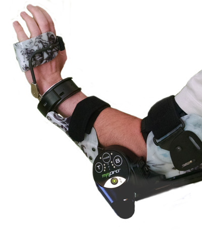 FDA-Compliant Medical Device Manufacturing of Myomo Myoelectric Upper Limb Orthosis
